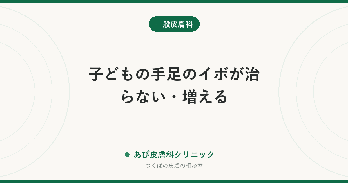 子どもの手足のイボが治らない・増える｜液体窒素が痛くて続かないときの選択肢と、うつさないための家庭での工夫