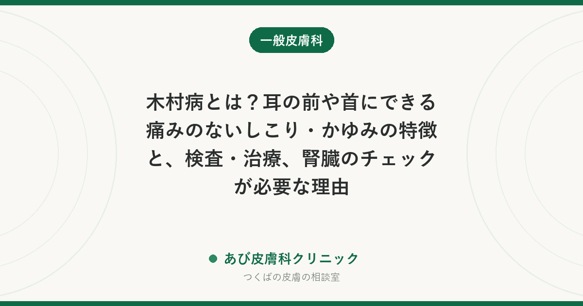 木村病とは？耳の前や首にできる痛みのないしこり・かゆみの特徴と、検査・治療、腎臓のチェックが必要な理由