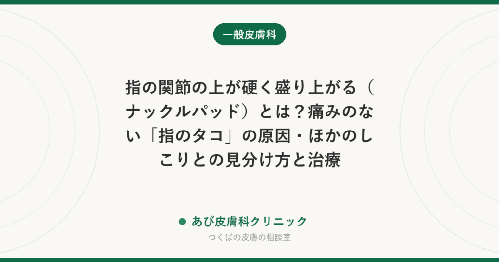 指の関節の上が硬く盛り上がる（ナックルパッド）とは？痛みのない「指のタコ」の原因・ほかのしこりとの見分け方と治療