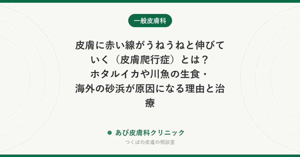 皮膚に赤い線がうねうねと伸びていく（皮膚爬行症）とは？ホタルイカや川魚の生食・海外の砂浜が原因になる理由と治療