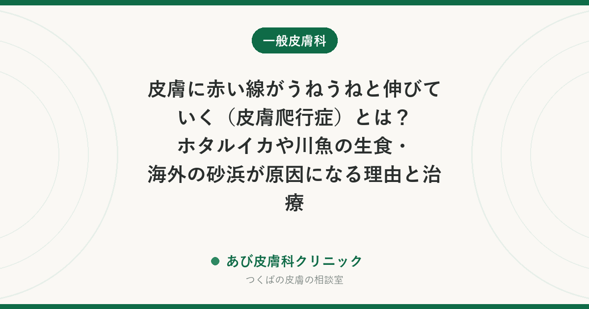 皮膚に赤い線がうねうねと伸びていく（皮膚爬行症）とは？ホタルイカや川魚の生食・海外の砂浜が原因になる理由と治療