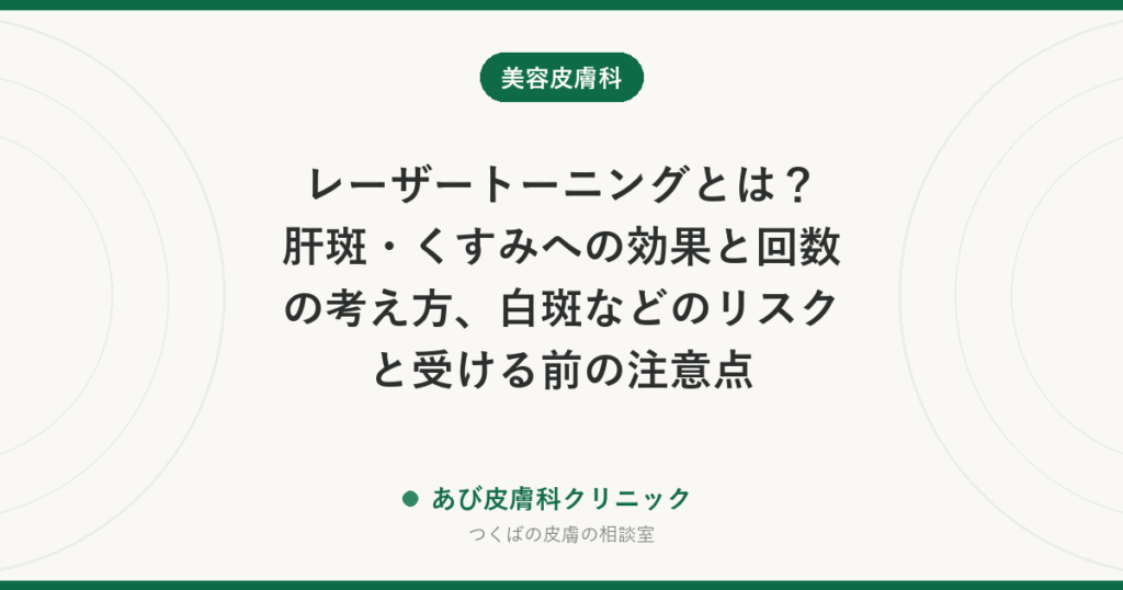レーザートーニングとは？肝斑・くすみへの効果と回数の考え方、白斑などのリスクと受ける前の注意点