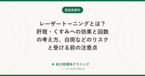 レーザートーニングとは？肝斑・くすみへの効果と回数の考え方、白斑などのリスクと受ける前の注意点