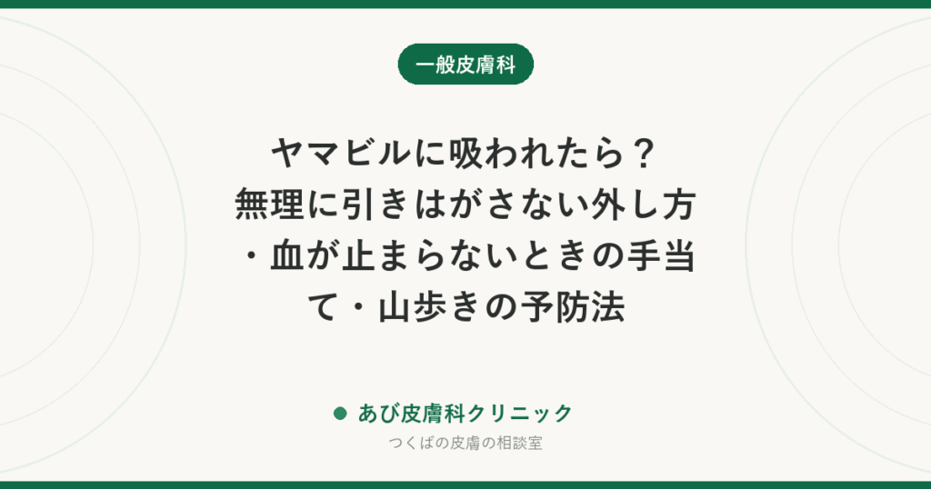 ヤマビルに吸われたら？無理に引きはがさない外し方・血が止まらないときの手当て・山歩きの予防法