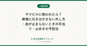 ヤマビルに吸われたら？無理に引きはがさない外し方・血が止まらないときの手当て・山歩きの予防法