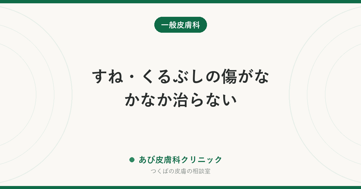 すね・くるぶしの傷がなかなか治らない｜下腿潰瘍（かたいかいよう）の原因と見分け方、受診の目安