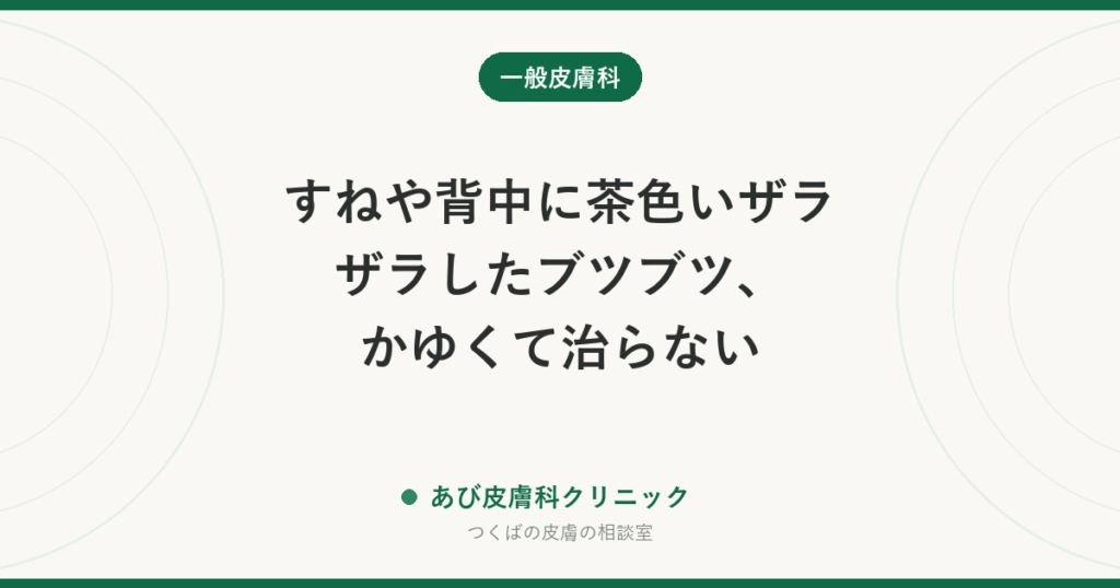 すねや背中に茶色いザラザラしたブツブツ、かゆくて治らない｜アミロイド苔癬とは？原因と治療、ナイロンタオルとの関係