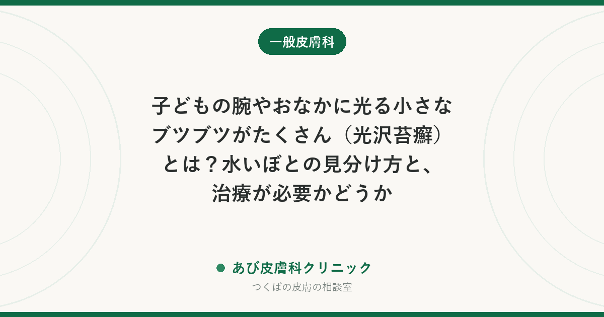子どもの腕やおなかに光る小さなブツブツがたくさん（光沢苔癬）とは？水いぼとの見分け方と、治療が必要かどうか