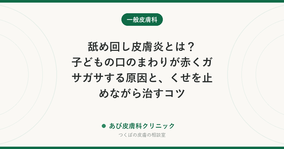 舐め回し皮膚炎とは？子どもの口のまわりが赤くガサガサする原因と、くせを止めながら治すコツ