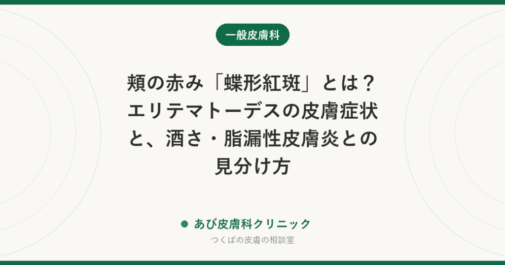 頬の赤み「蝶形紅斑」とは？エリテマトーデスの皮膚症状と、酒さ・脂漏性皮膚炎との見分け方