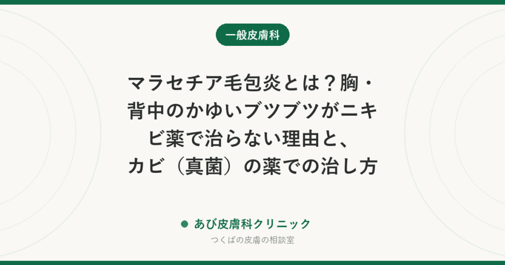 マラセチア毛包炎とは？胸・背中のかゆいブツブツがニキビ薬で治らない理由と、カビ（真菌）の薬での治し方