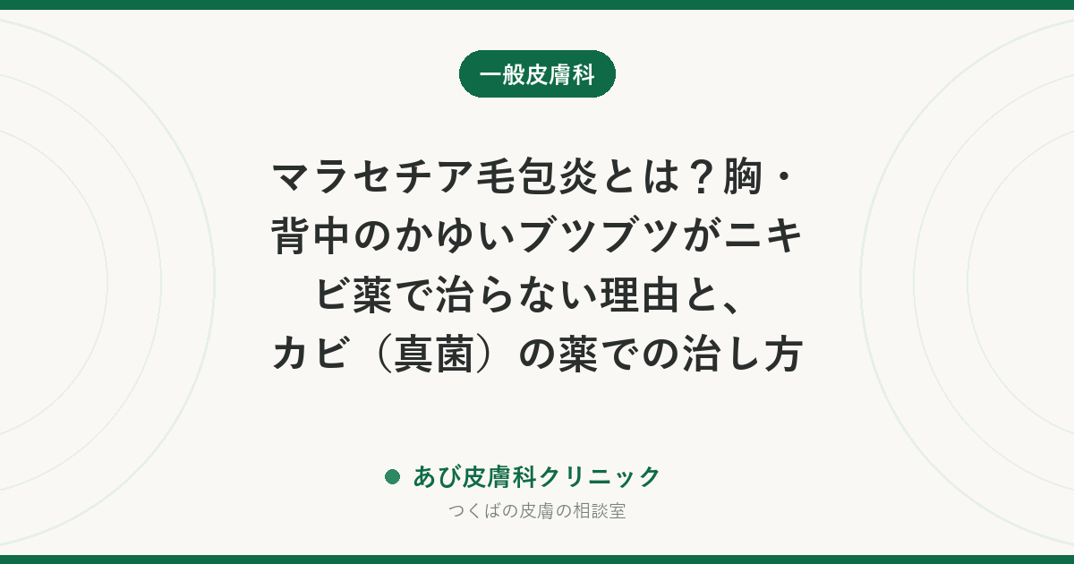 マラセチア毛包炎とは？胸・背中のかゆいブツブツがニキビ薬で治らない理由と、カビ（真菌）の薬での治し方