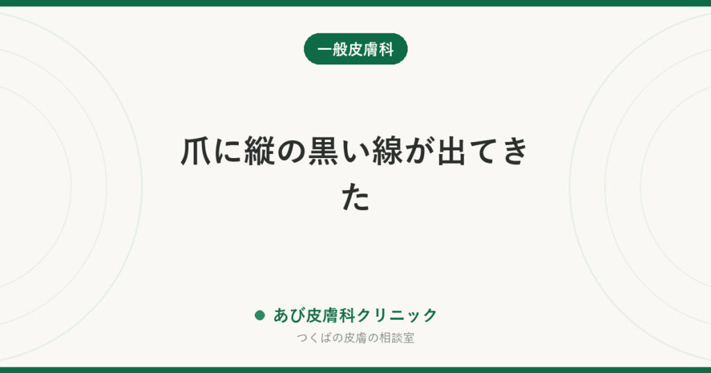 爪に縦の黒い線が出てきた｜爪甲色素線条の原因と、メラノーマとの見分け方・皮膚科を受診する目安