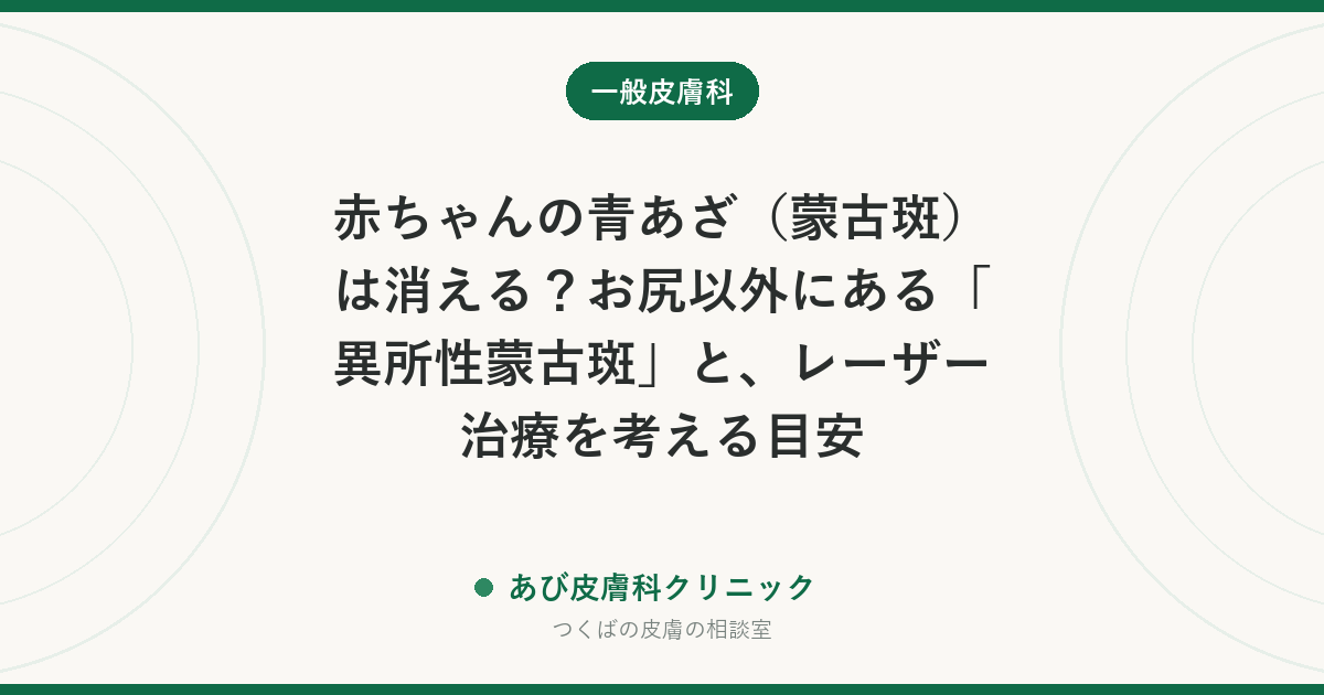 赤ちゃんの青あざ（蒙古斑）は消える？お尻以外にある「異所性蒙古斑」と、レーザー治療を考える目安