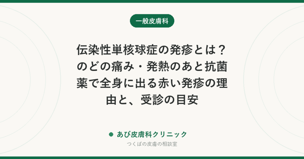 伝染性単核球症の発疹とは？のどの痛み・発熱のあと抗菌薬で全身に出る赤い発疹の理由と、受診の目安