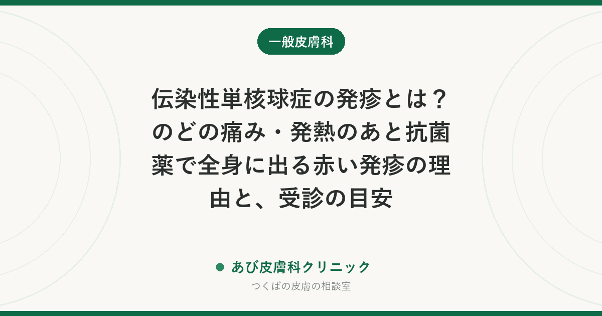 伝染性単核球症の発疹とは？のどの痛み・発熱のあと抗菌薬で全身に出る赤い発疹の理由と、受診の目安