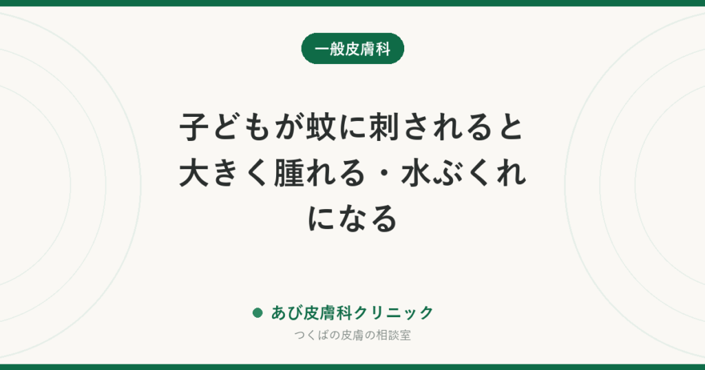 子どもが蚊に刺されると大きく腫れる・水ぶくれになる｜大人と違う理由、冷やし方と塗り薬、受診の目安