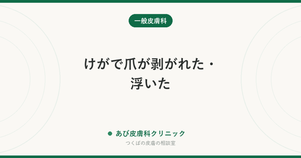 けがで爪が剥がれた・浮いた｜その場でする手当て、剥がれかけの爪は取るべきか、生えそろうまでの期間
