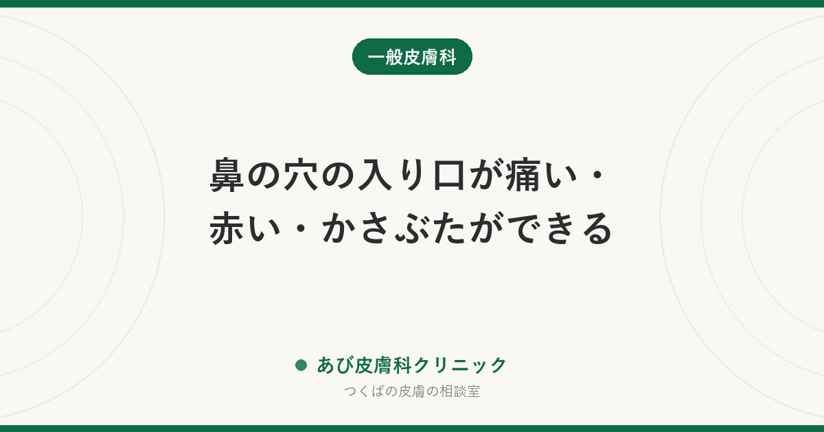 鼻の穴の入り口が痛い・赤い・かさぶたができる｜鼻前庭炎の原因と治し方、受診の目安