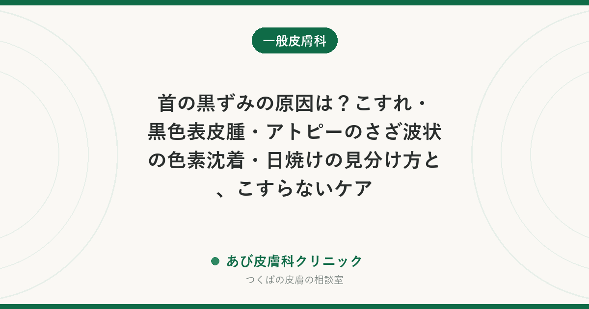 首の黒ずみの原因は？こすれ・黒色表皮腫・アトピーのさざ波状の色素沈着・日焼けの見分け方と、こすらないケア