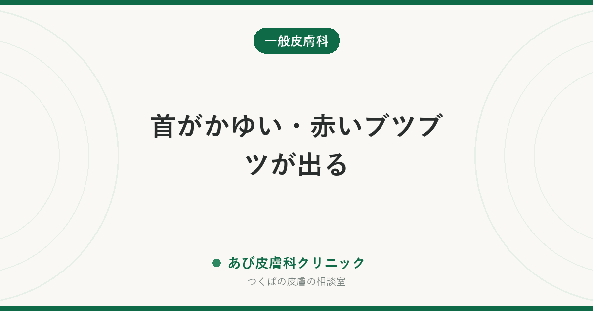 首がかゆい・赤いブツブツが出る｜汗・かぶれ・アトピー・金属アレルギーの見分け方と治し方