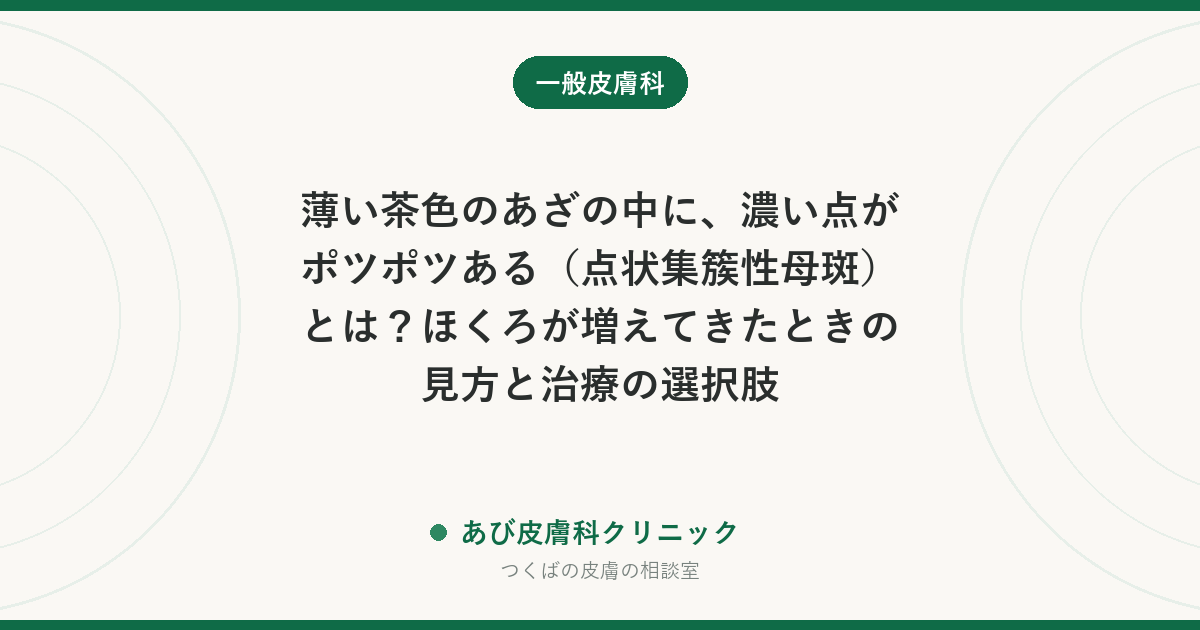 薄い茶色のあざの中に、濃い点がポツポツある（点状集簇性母斑）とは？ほくろが増えてきたときの見方と治療の選択肢