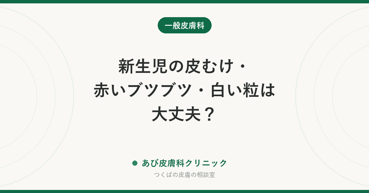 新生児の皮むけ・赤いブツブツ・白い粒は大丈夫？｜生後1か月までによくある肌の変化と、受診したほうがよいサイン