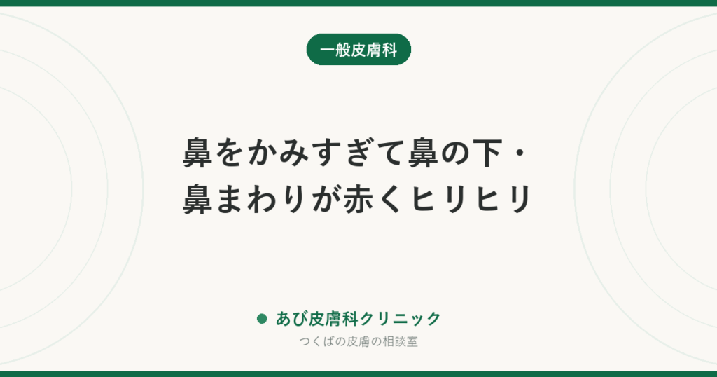 鼻をかみすぎて鼻の下・鼻まわりが赤くヒリヒリ｜荒れの治し方と予防、ヘルペス・とびひとの見分け方