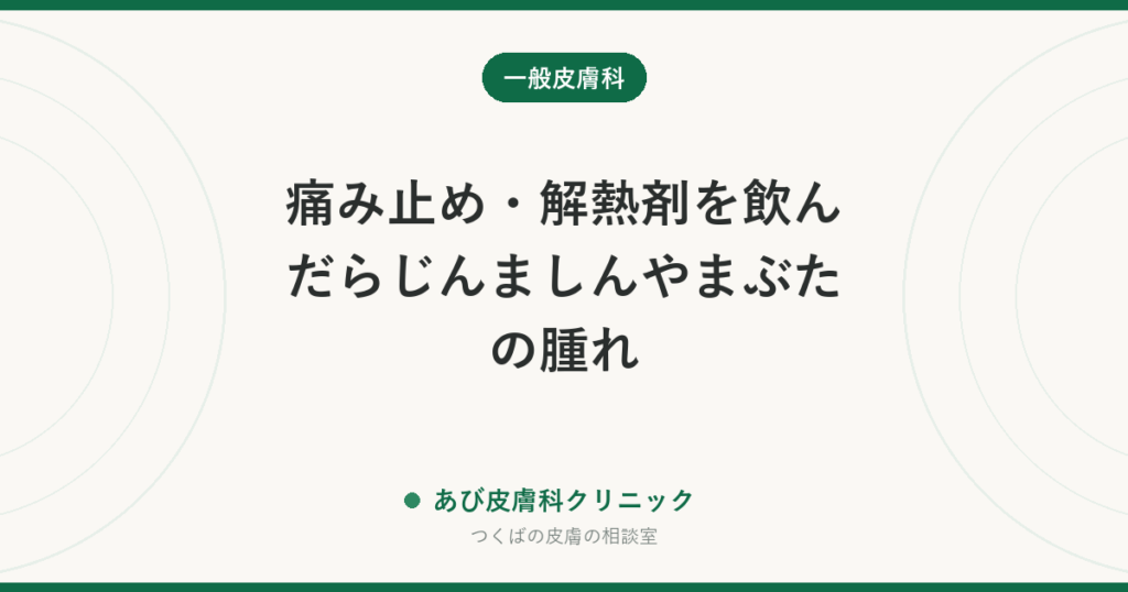 痛み止め・解熱剤を飲んだらじんましんやまぶたの腫れ｜NSAIDs過敏症の見分け方と、次に使える薬の考え方