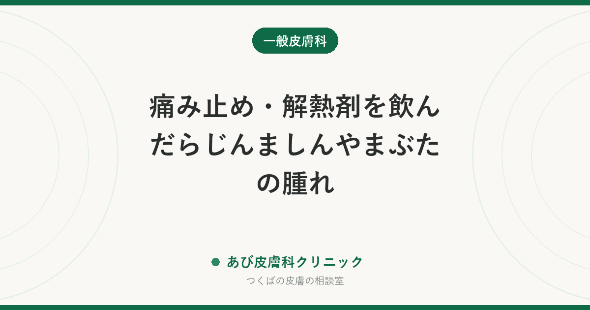 痛み止め・解熱剤を飲んだらじんましんやまぶたの腫れ｜NSAIDs過敏症の見分け方と、次に使える薬の考え方