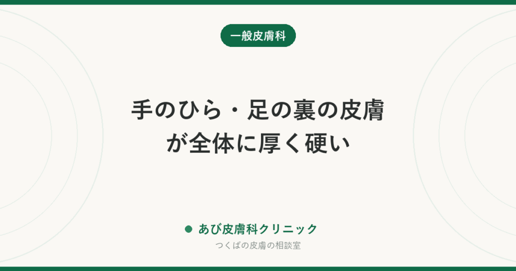 手のひら・足の裏の皮膚が全体に厚く硬い｜掌蹠角化症（しょうせきかくかしょう）とは？タコ・水虫との違いとケアの方法