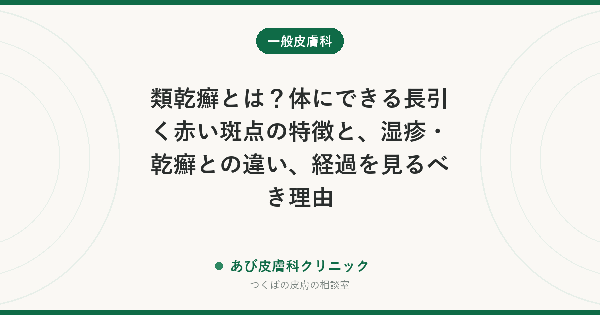 類乾癬とは？体にできる長引く赤い斑点の特徴と、湿疹・乾癬との違い、経過を見るべき理由