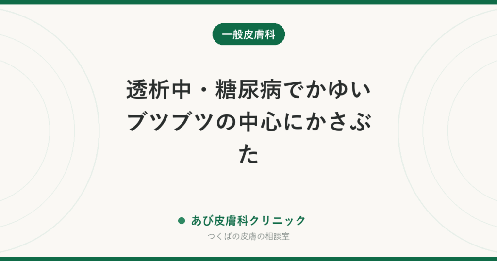 透析中・糖尿病でかゆいブツブツの中心にかさぶた｜後天性反応性穿孔性膠原症とは？治療と受診の目安