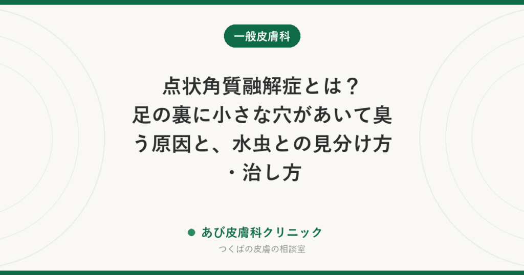 点状角質融解症とは？足の裏に小さな穴があいて臭う原因と、水虫との見分け方・治し方