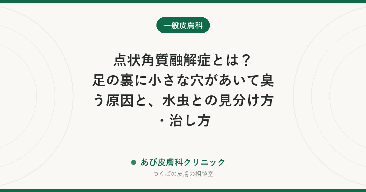 点状角質融解症とは？足の裏に小さな穴があいて臭う原因と、水虫との見分け方・治し方