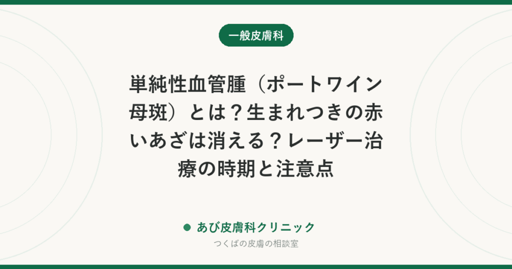 単純性血管腫（ポートワイン母斑）とは？生まれつきの赤いあざは消える？レーザー治療の時期と注意点
