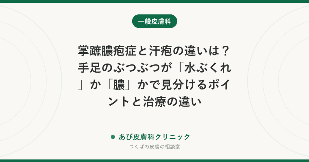 掌蹠膿疱症と汗疱の違いは？手足のぶつぶつが「水ぶくれ」か「膿」かで見分けるポイントと治療の違い