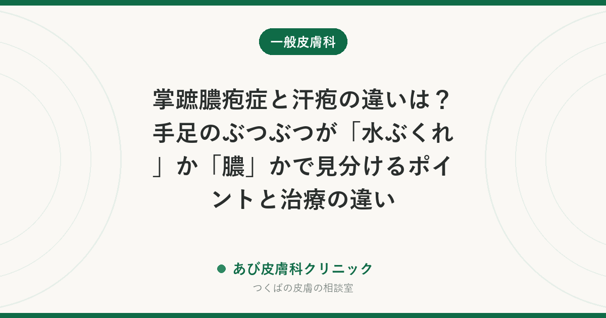 掌蹠膿疱症と汗疱の違いは？手足のぶつぶつが「水ぶくれ」か「膿」かで見分けるポイントと治療の違い
