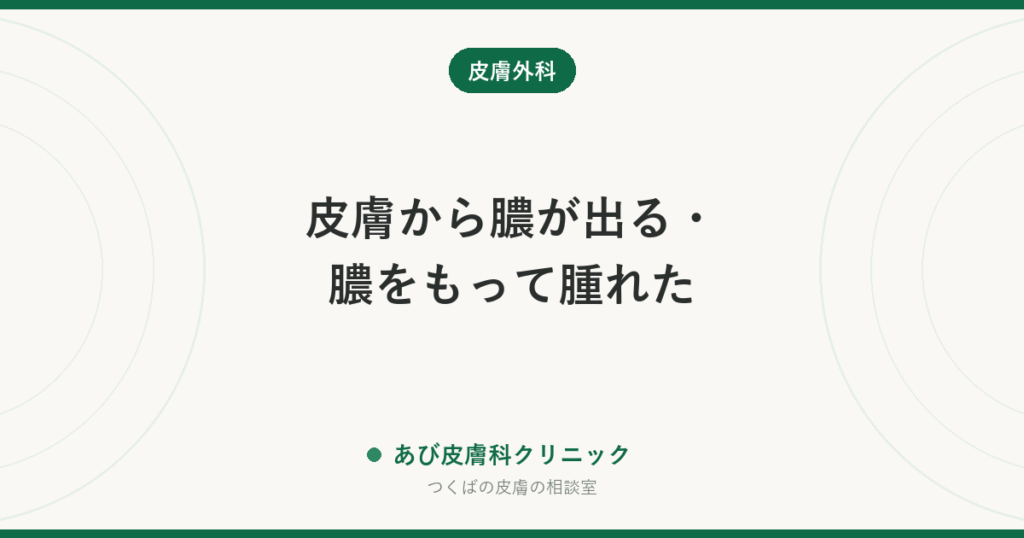 皮膚から膿が出る・膿をもって腫れた｜考えられる原因（粉瘤・毛包炎・ひょう疽など）と自分で出していいか