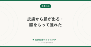 皮膚から膿が出る・膿をもって腫れた｜考えられる原因（粉瘤・毛包炎・ひょう疽など）と自分で出していいか