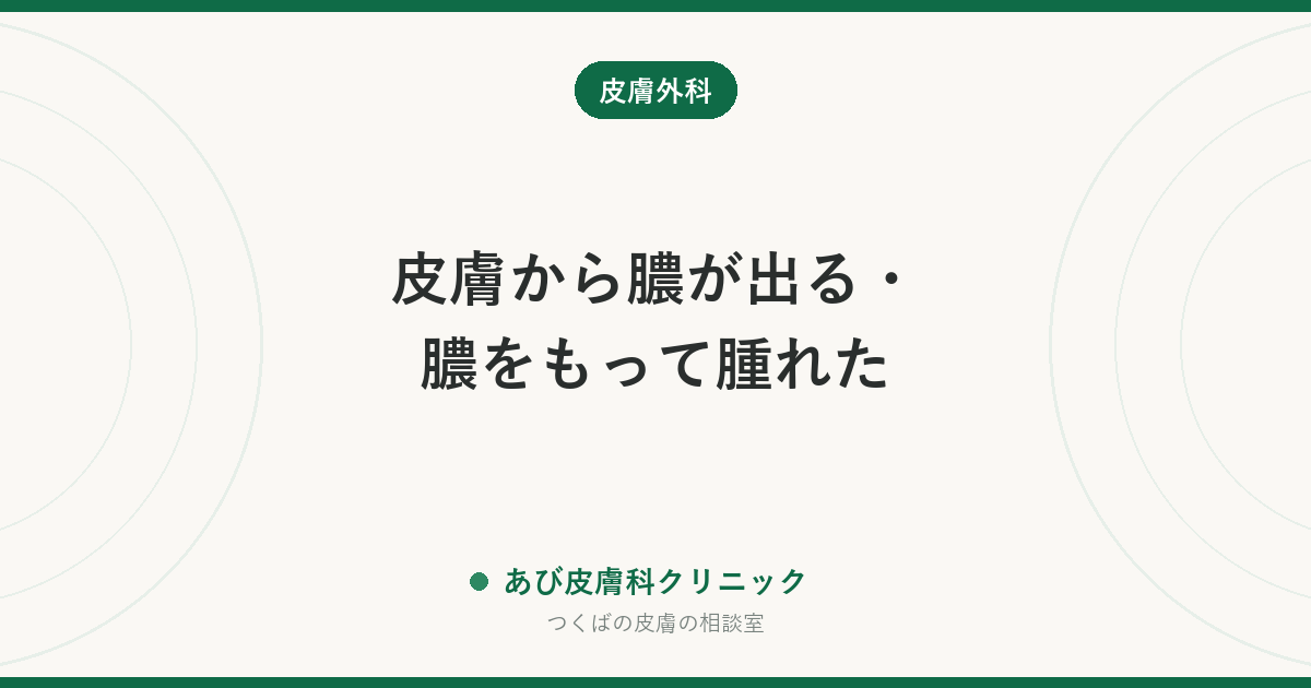 皮膚から膿が出る・膿をもって腫れた｜考えられる原因（粉瘤・毛包炎・ひょう疽など）と自分で出していいか