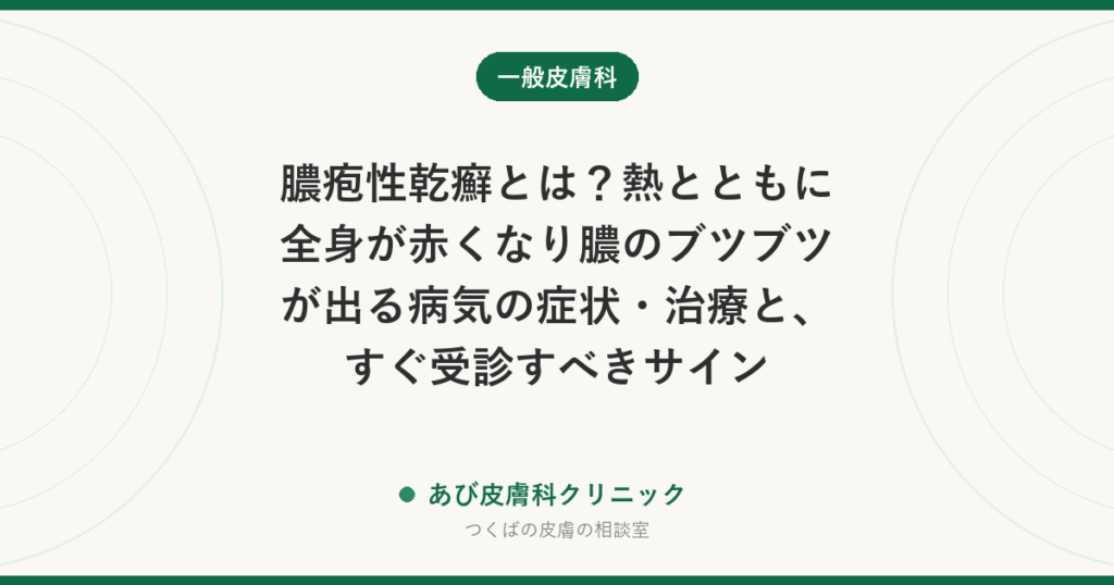 膿疱性乾癬とは？熱とともに全身が赤くなり膿のブツブツが出る病気の症状・治療と、すぐ受診すべきサイン