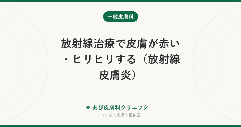 放射線治療で皮膚が赤い・ヒリヒリする（放射線皮膚炎）｜治療中にしてよいケア・避けたいことと、相談の目安