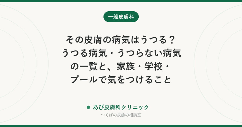その皮膚の病気はうつる？うつる病気・うつらない病気の一覧と、家族・学校・プールで気をつけること