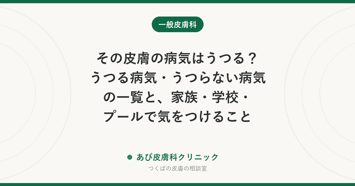 その皮膚の病気はうつる？うつる病気・うつらない病気の一覧と、家族・学校・プールで気をつけること