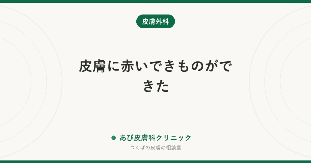 皮膚に赤いできものができた｜赤いほくろ・おでき・血が出るできものの見分け方と受診の目安