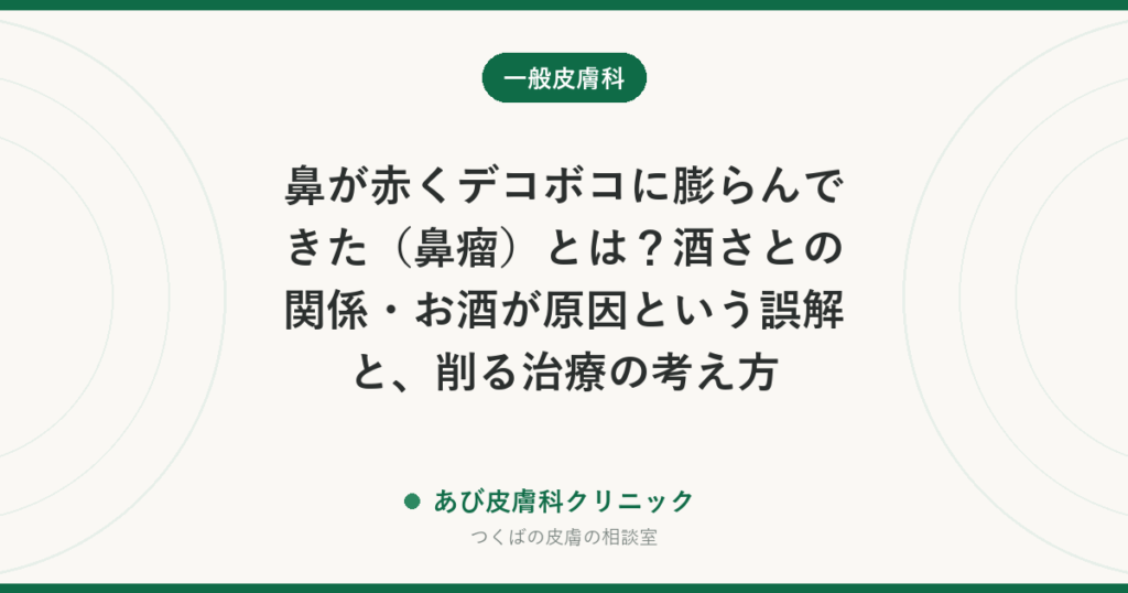 鼻が赤くデコボコに膨らんできた（鼻瘤）とは？酒さとの関係・お酒が原因という誤解と、削る治療の考え方