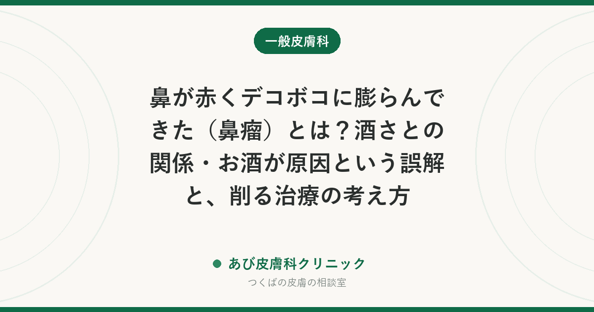 鼻が赤くデコボコに膨らんできた（鼻瘤）とは？酒さとの関係・お酒が原因という誤解と、削る治療の考え方