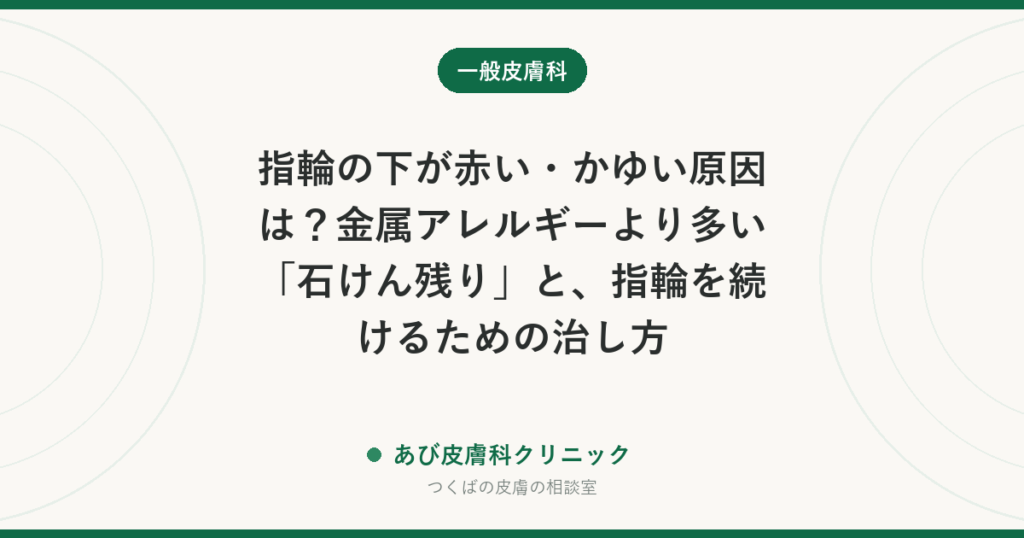 指輪の下が赤い・かゆい原因は？金属アレルギーより多い「石けん残り」と、指輪を続けるための治し方