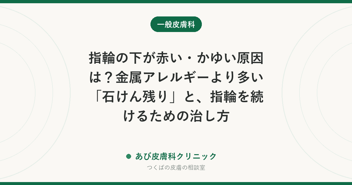 指輪の下が赤い・かゆい原因は？金属アレルギーより多い「石けん残り」と、指輪を続けるための治し方